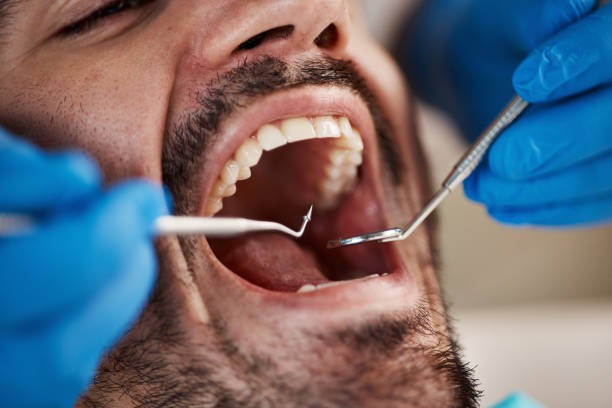 Best Emergency Dental Care for Abscessed Tooth in Midland City, AL