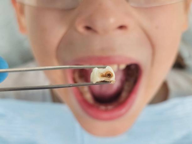 Best Emergency Dental Services for Seniors in Midland City, AL